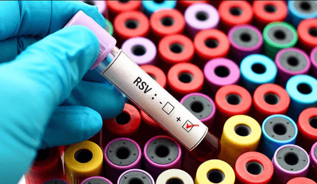 RSV Enfeksiyonu Nedir