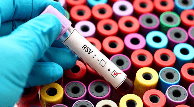 RSV Enfeksiyonu Nedir